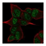 Atlas Antibodies Anti-ANGEL2 Antibody