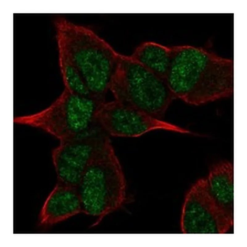Atlas Antibodies Anti-ANGEL2 Antibody