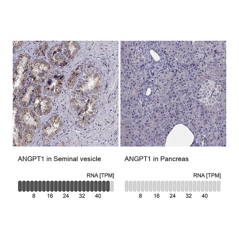 Atlas Antibodies Anti-ANGPT1 Antibody