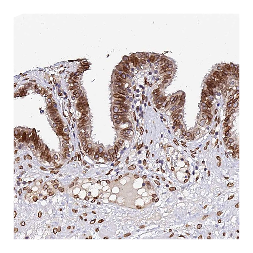 Atlas Antibodies Anti-ANAPC5 Antibody