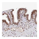 Atlas Antibodies Anti-ANAPC5 Antibody