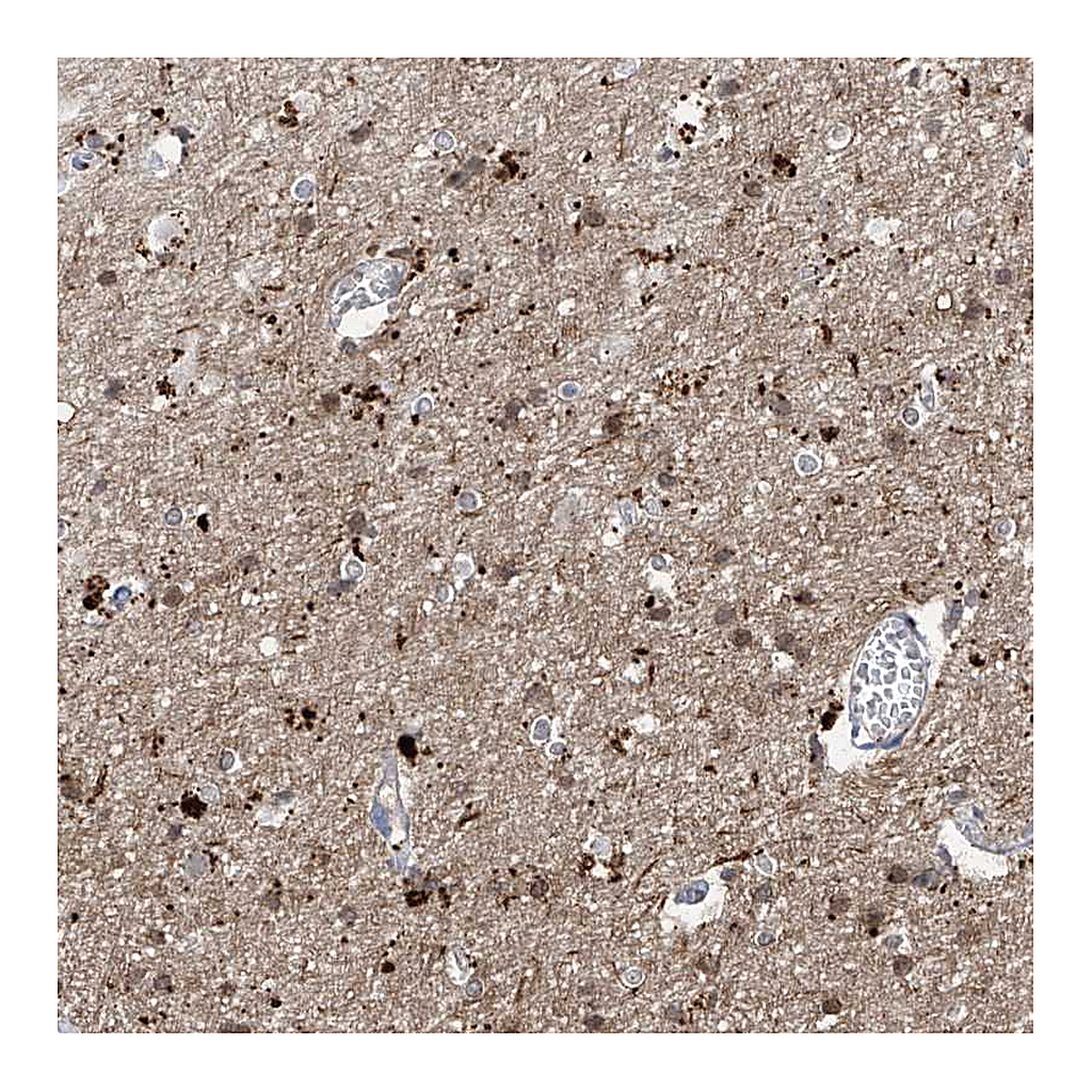 Atlas Antibodies Anti-ANGEL2 Antibody
