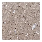 Atlas Antibodies Anti-ANGEL2 Antibody