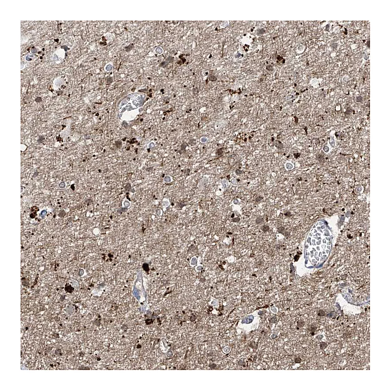 Atlas Antibodies Anti-ANGEL2 Antibody