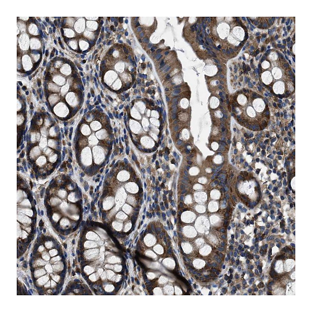 Atlas Antibodies Anti-ANGPT1 Antibody