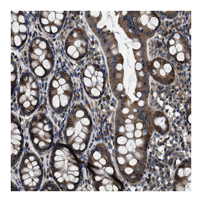 Atlas Antibodies Anti-ANGPT1 Antibody