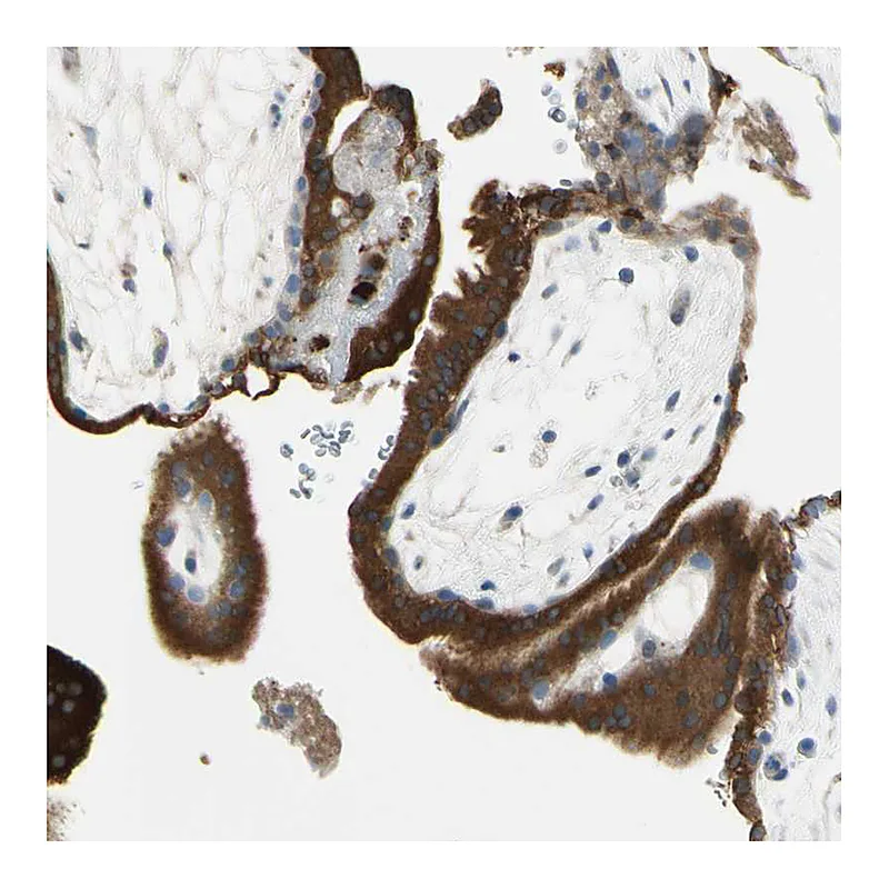 Atlas Antibodies Anti-ANGPTL1 Antibody