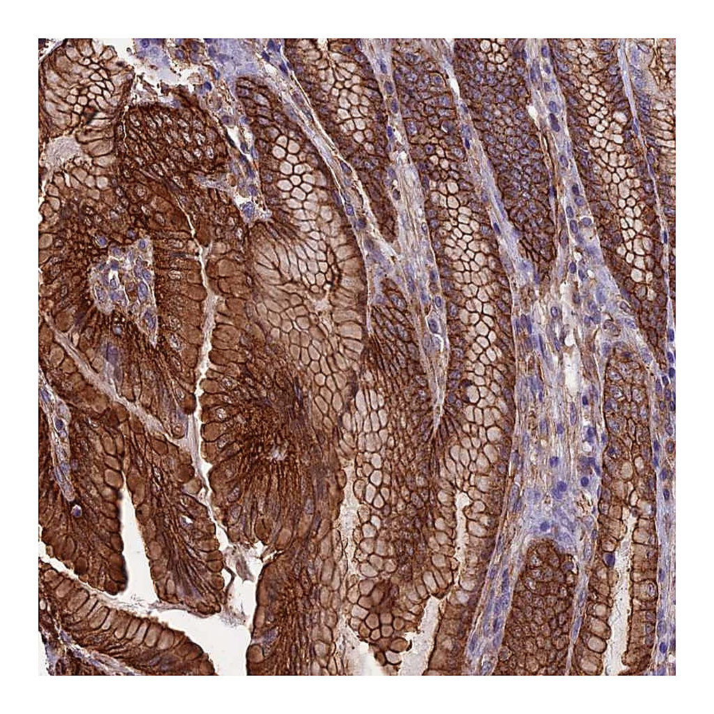 Atlas Antibodies Anti-ANGPTL2 Antibody