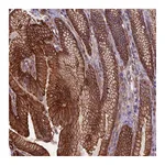 Atlas Antibodies Anti-ANGPTL2 Antibody