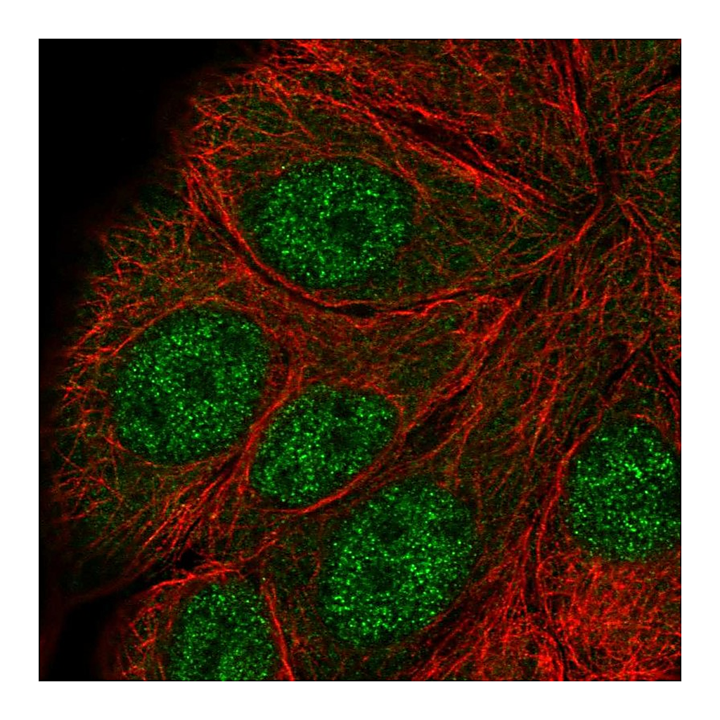 Atlas Antibodies Anti-ANAPC5 Antibody