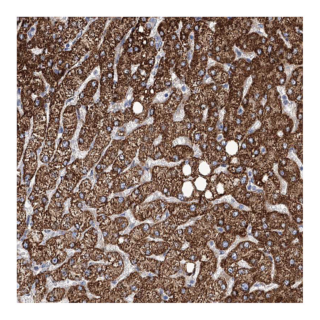 Atlas Antibodies Anti-ANGPTL3 Antibody