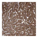 Atlas Antibodies Anti-ANGPTL3 Antibody