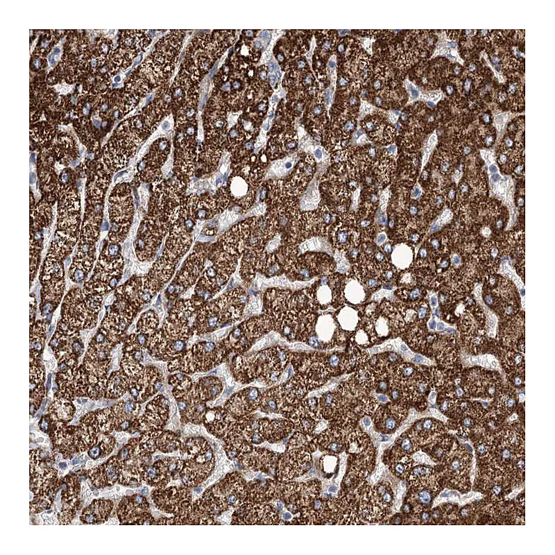 Atlas Antibodies Anti-ANGPTL3 Antibody