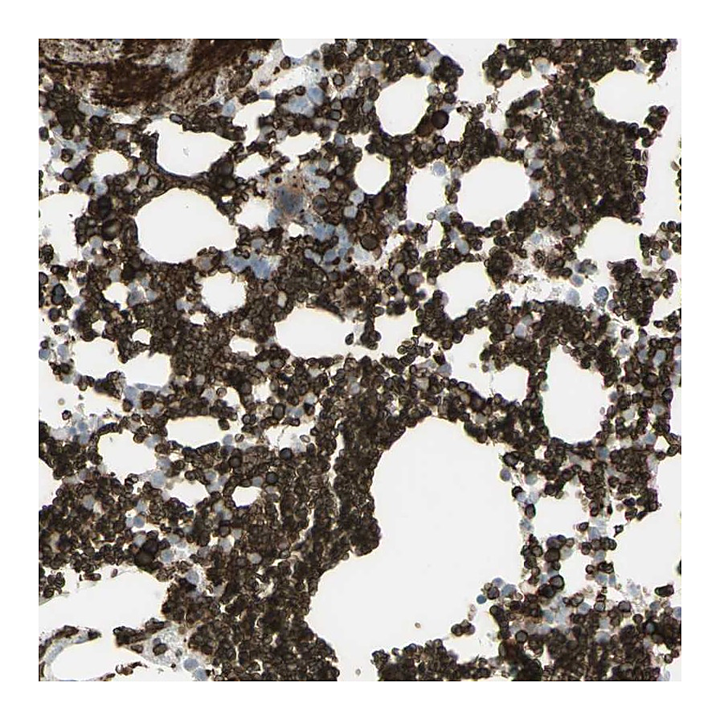 Atlas Antibodies Anti-ANK1 Antibody