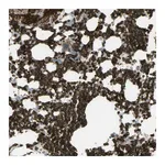 Atlas Antibodies Anti-ANK1 Antibody