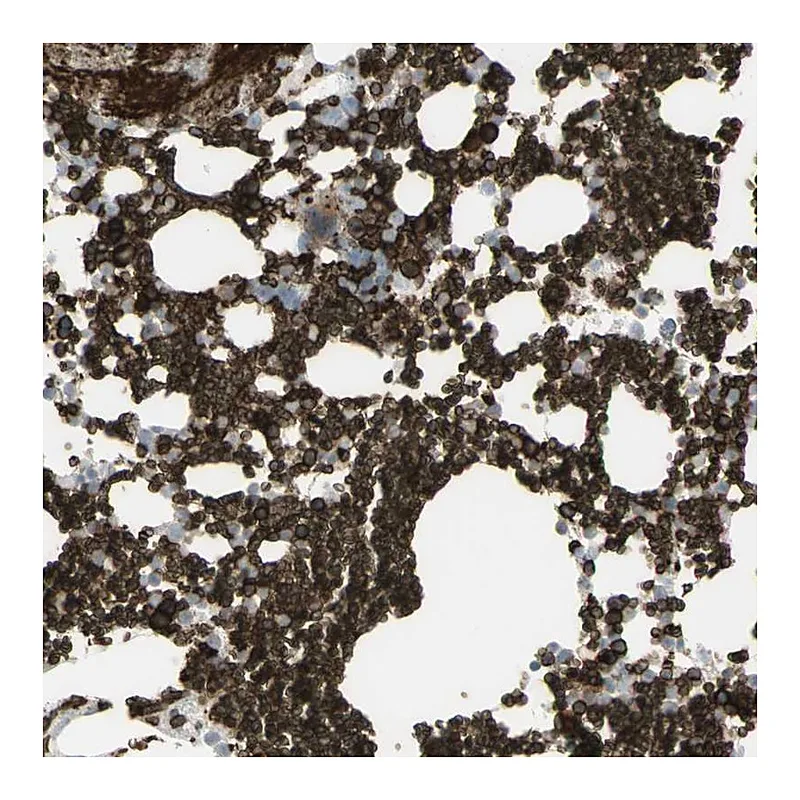 Atlas Antibodies Anti-ANK1 Antibody