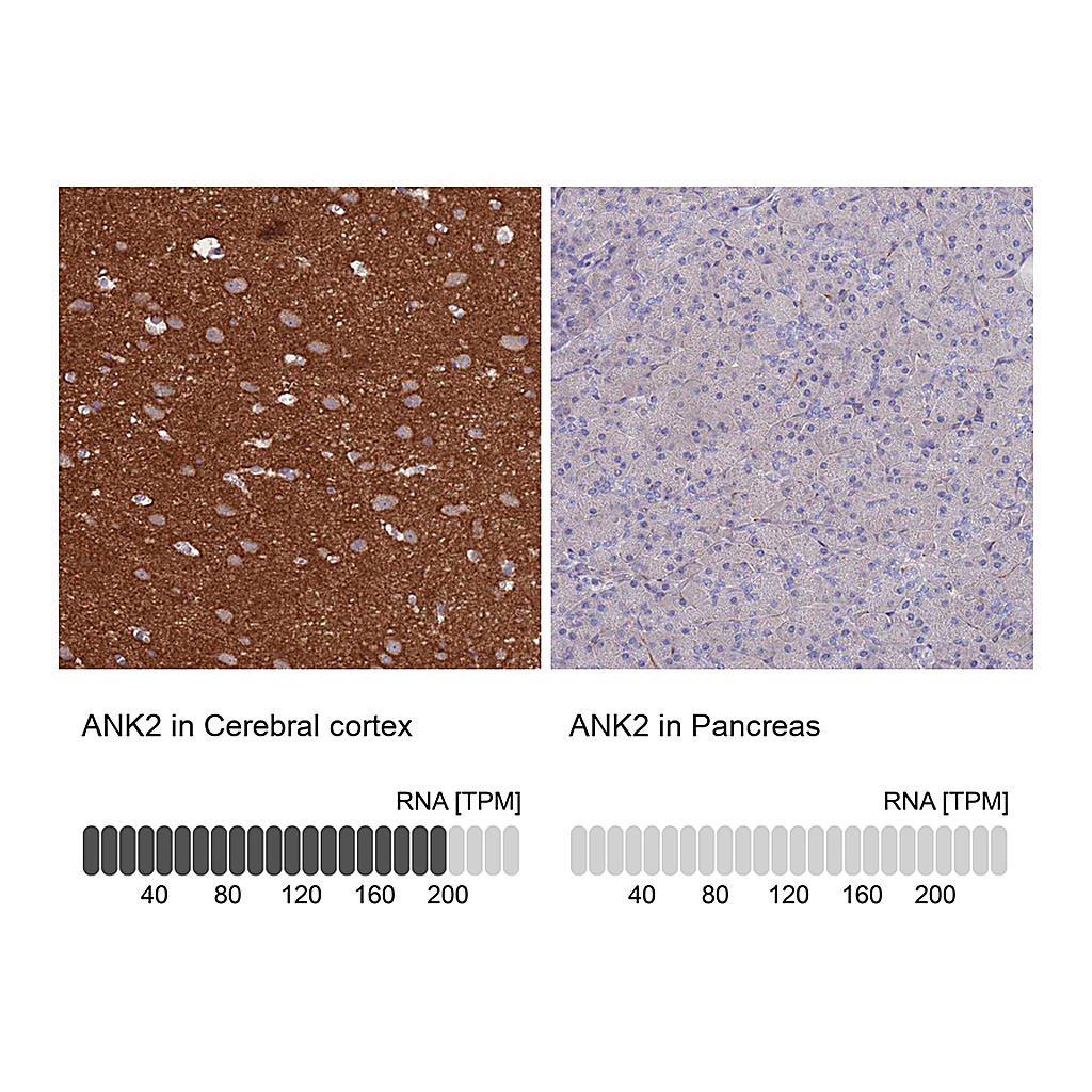 Atlas Antibodies Anti-ANK2 Antibody