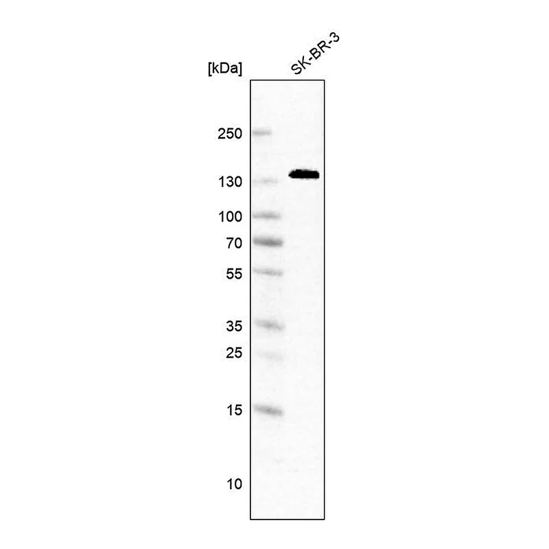 Atlas Antibodies Anti-ANK3 Antibody