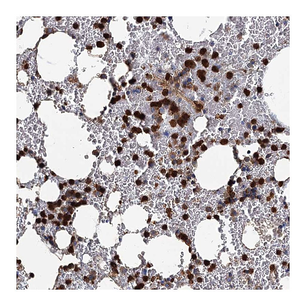 Atlas Antibodies Anti-ANKDD1A Antibody