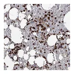 Atlas Antibodies Anti-ANKDD1A Antibody