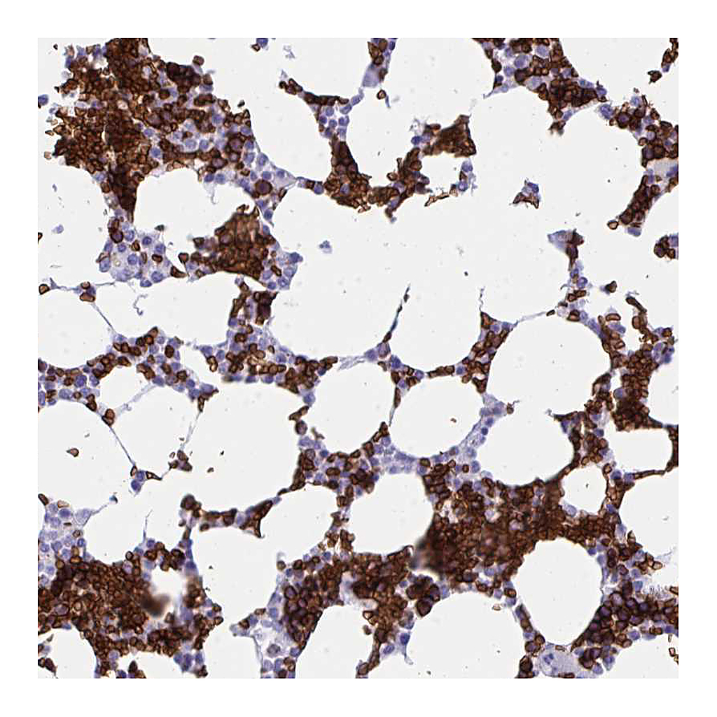 Atlas Antibodies Anti-ANK1 Antibody