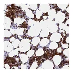 Atlas Antibodies Anti-ANK1 Antibody