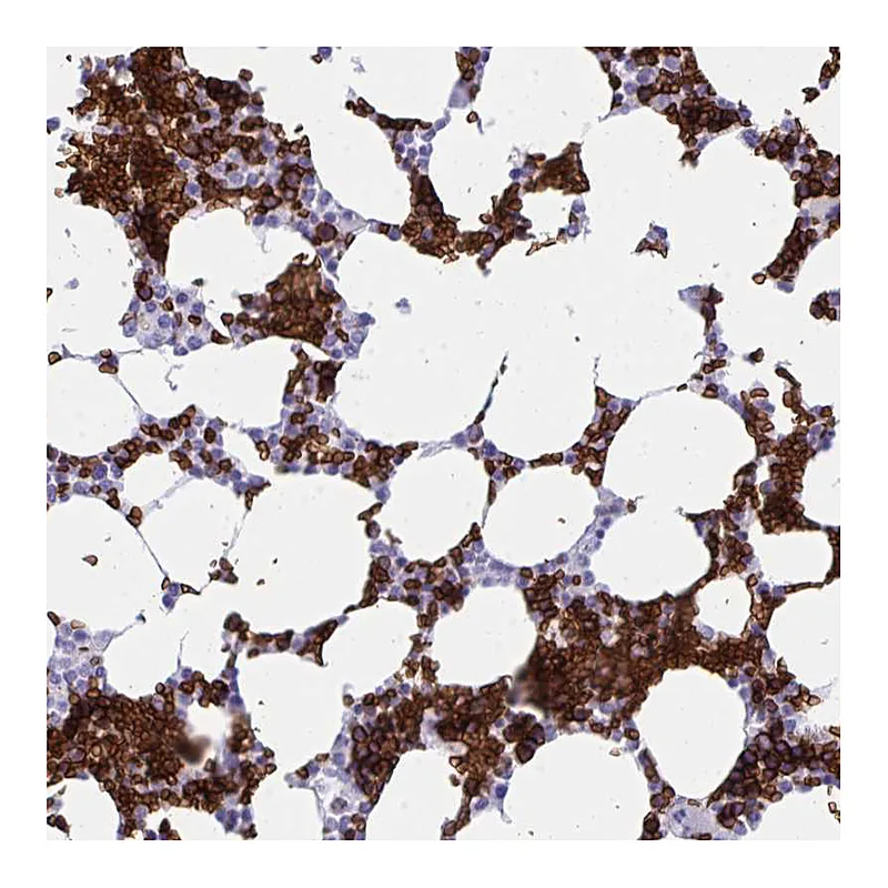 Atlas Antibodies Anti-ANK1 Antibody