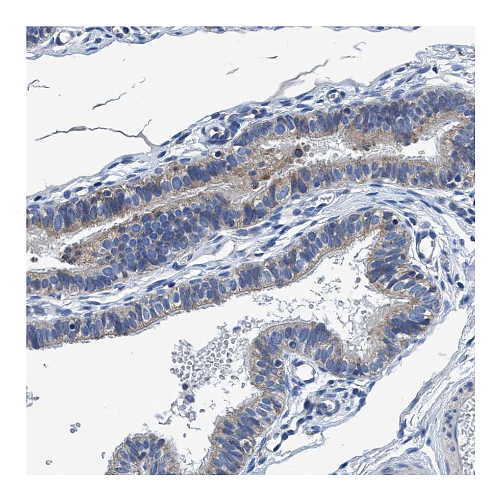 Atlas Antibodies Anti-ANKFN1 Antibody