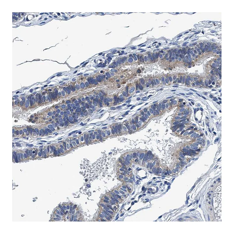 Atlas Antibodies Anti-ANKFN1 Antibody