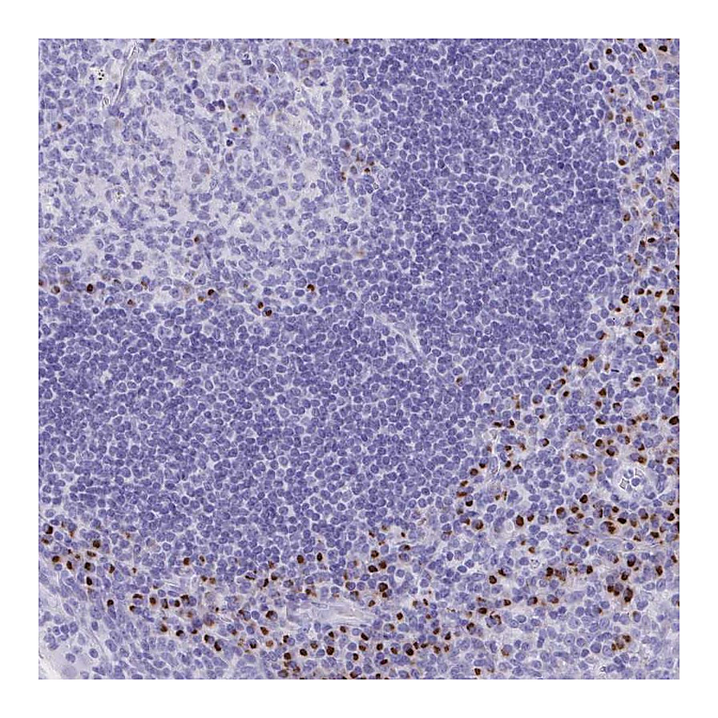 Atlas Antibodies Anti-ANKDD1B Antibody