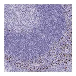 Atlas Antibodies Anti-ANKDD1B Antibody