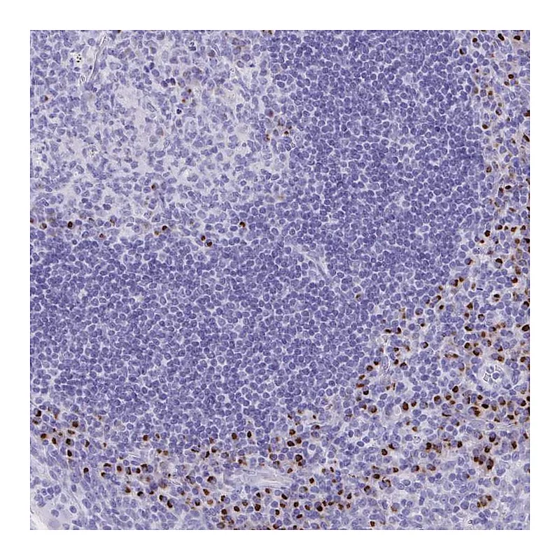 Atlas Antibodies Anti-ANKDD1B Antibody