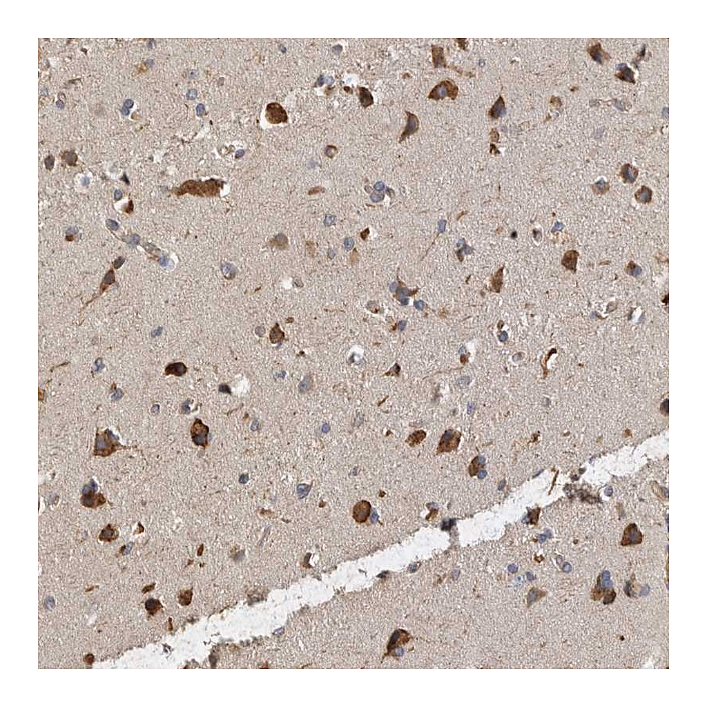 Atlas Antibodies Anti-ANKFY1 Antibody