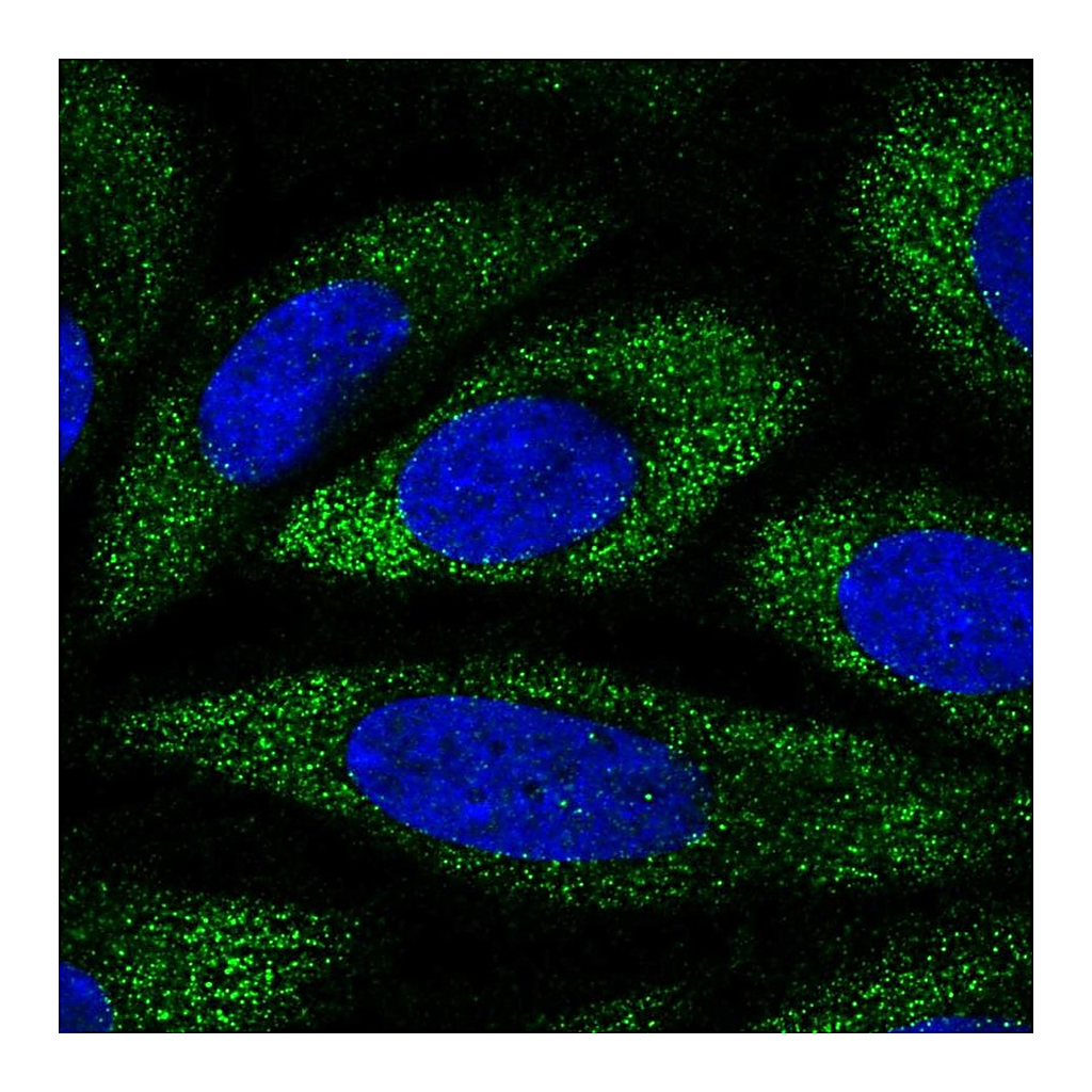 Atlas Antibodies Anti-ANKH Antibody