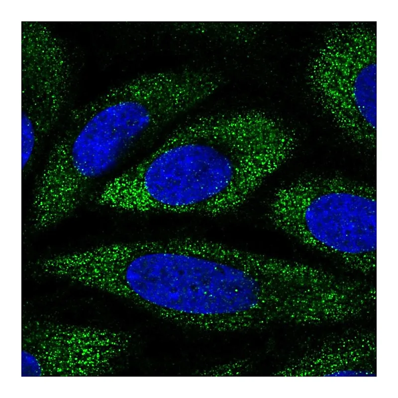 Atlas Antibodies Anti-ANKH Antibody