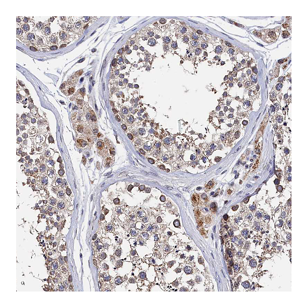 Atlas Antibodies Anti-ANKEF1 Antibody