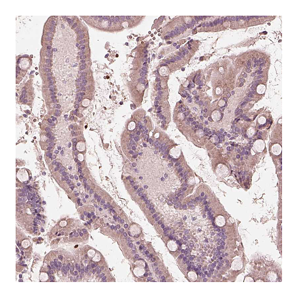 Atlas Antibodies Anti-ANKLE1 Antibody