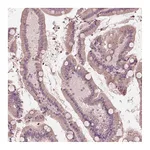 Atlas Antibodies Anti-ANKLE1 Antibody