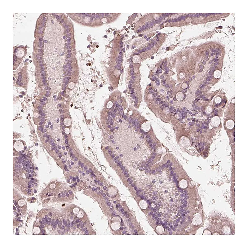 Atlas Antibodies Anti-ANKLE1 Antibody