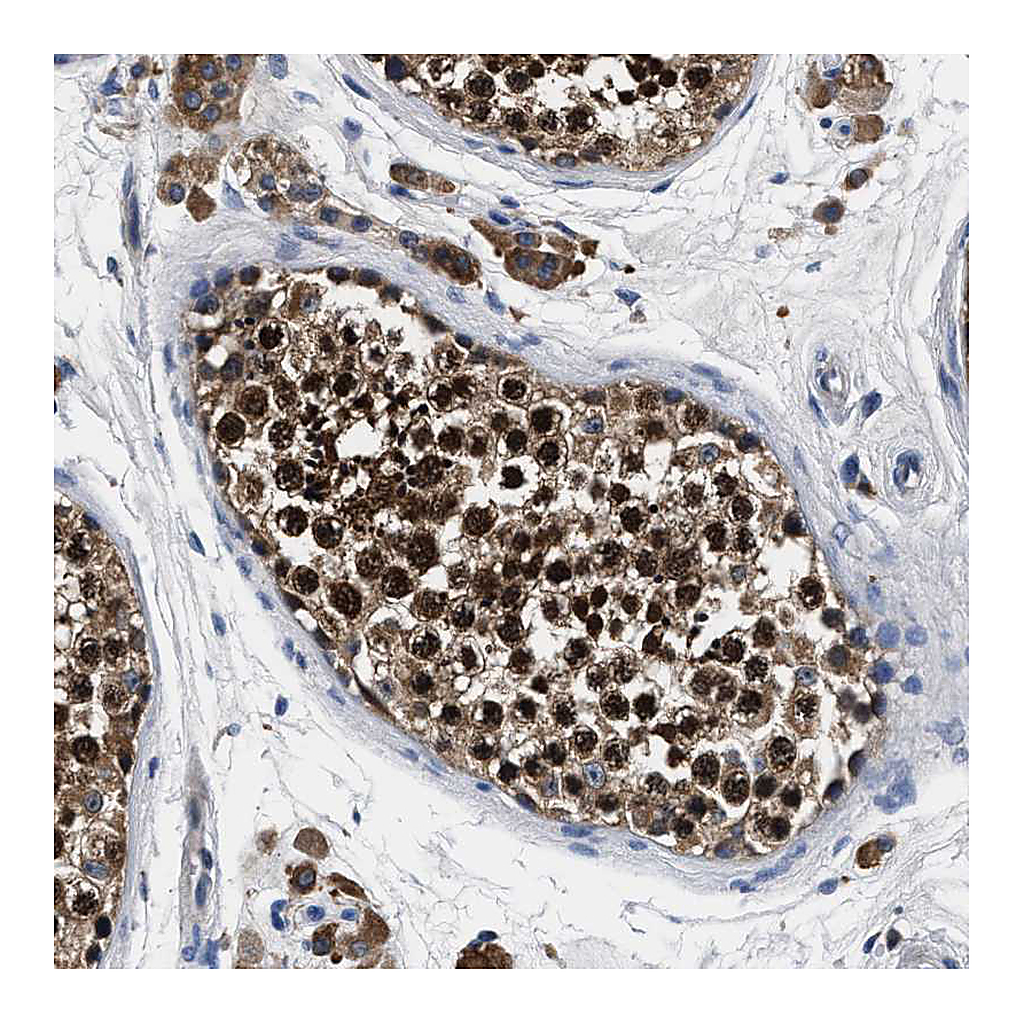 Atlas Antibodies Anti-ANKIB1 Antibody
