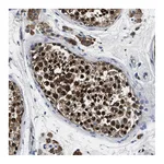 Atlas Antibodies Anti-ANKIB1 Antibody