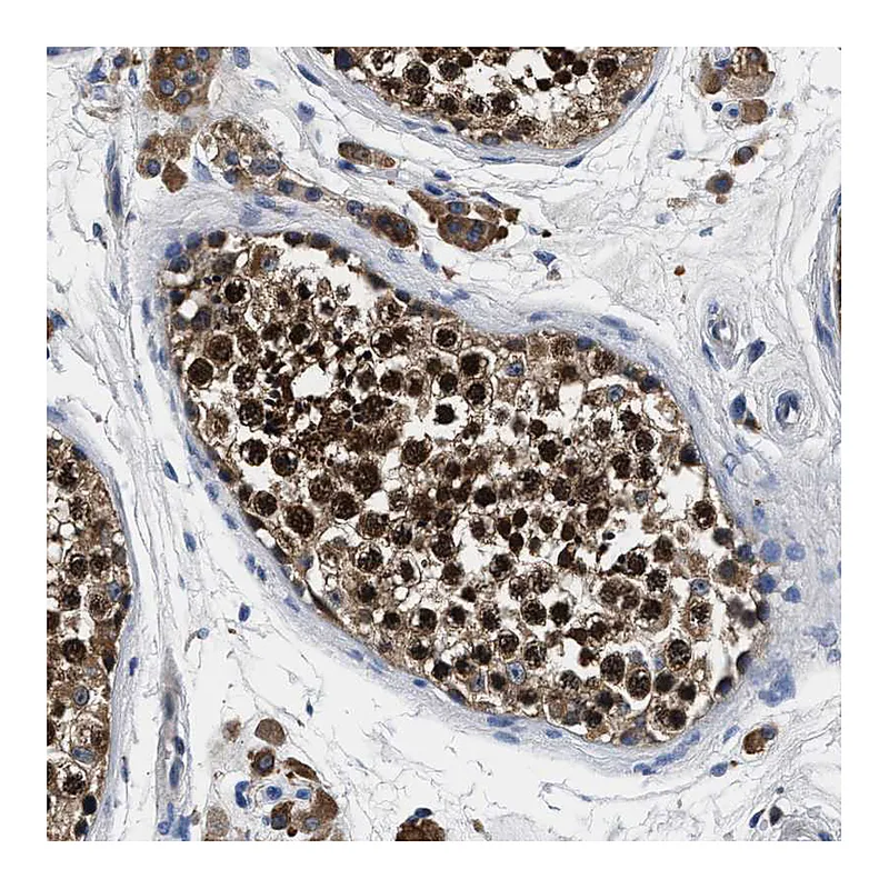 Atlas Antibodies Anti-ANKIB1 Antibody