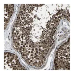 Atlas Antibodies Anti-ANKIB1 Antibody