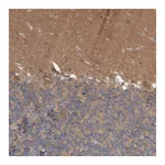 Atlas Antibodies Anti-ANKK1 Antibody