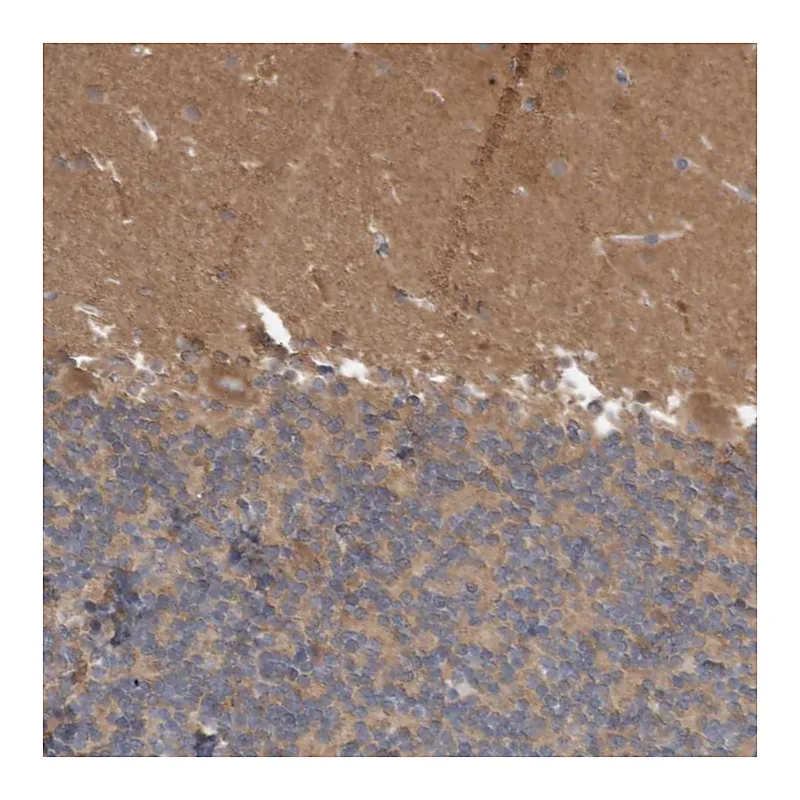 Atlas Antibodies Anti-ANKK1 Antibody