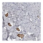 Atlas Antibodies Anti-ANKMY1 Antibody