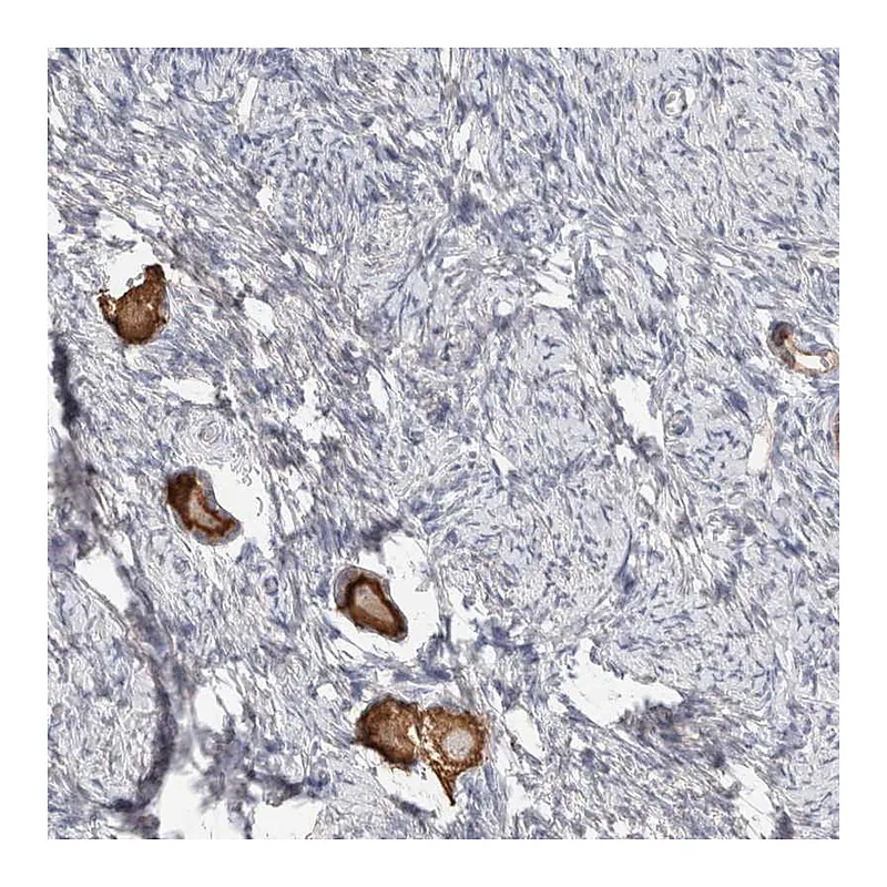 Atlas Antibodies Anti-ANKMY1 Antibody