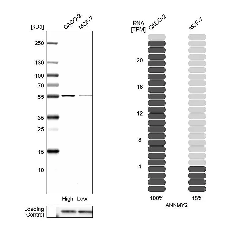 Atlas Antibodies Anti-ANKMY2 Antibody
