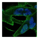 Atlas Antibodies Anti-ANKRA2 Antibody