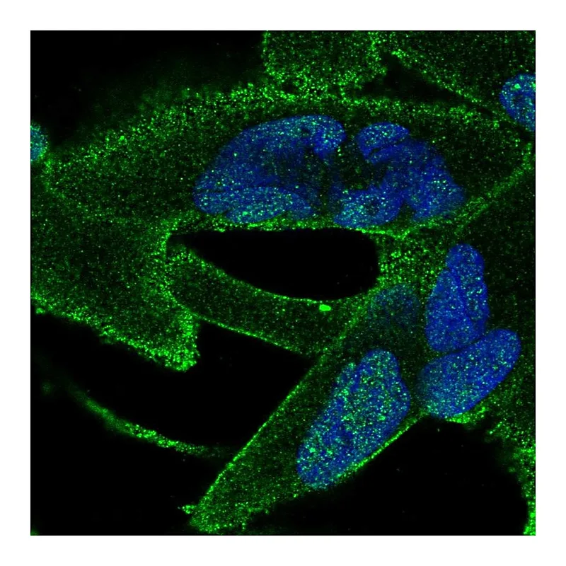 Atlas Antibodies Anti-ANKRA2 Antibody